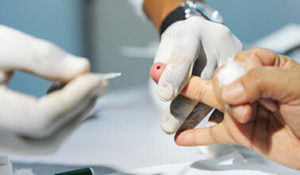Hepatite teste