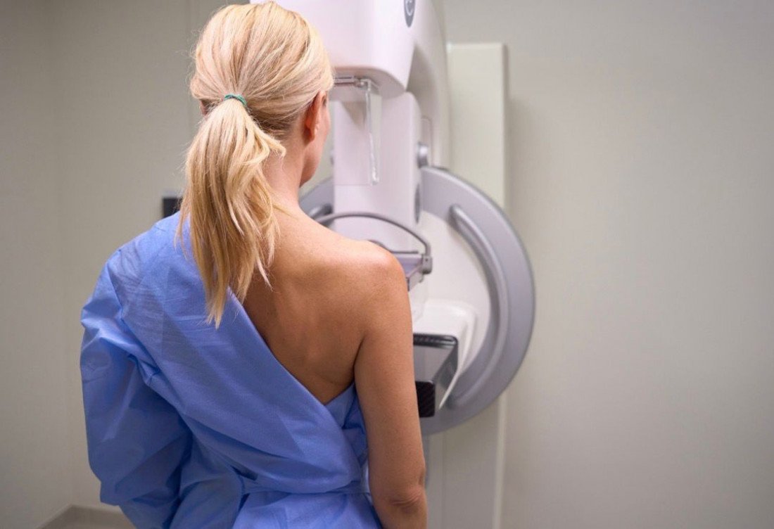 Mamografia aos 40: um passo a mais na luta contra o câncer de mama, por Dr. César Titton